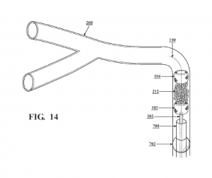 ClotHound device in a blood vessel, emerging from an aspiration catheter, with distal and proximal spheres sandwiching a red clot for safe and precise removal during a vascular occlusion procedure.