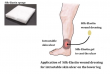 Sanyo Chemical's Silk-Elastin Shows Promise in Wound Healing