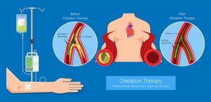 Chelation:  How it works4