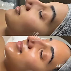 Skin Treatment Toronto