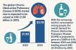 Global Chronic Obstructive Pulmonary Disease (COPD) Market to Reach USD 33.19 Billion by 2033 at a CAGR of 4.4% | FMI