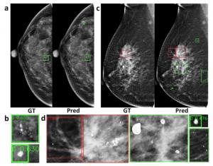 Figure 1: Results of microcalcification detection experiments.