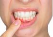 Bronte Road Family Dental Introduces Picasso Soft Tissue Laser Technology for Enhanced Patient Care
