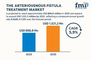 Arteriovenous Fistula Treatment