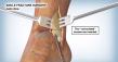 Artery Studios Highlights the Critical Role of Medical Illustration in Litigation Proceedings