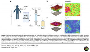 Extracorporeal therapeutic apheresis removesmicroplastic- and nanoplastic-like particles from human blood
