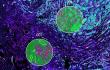 New Study Advances Cancer Precision Therapies by Identifying Patients Who Benefit from Bexmarilimab treatment