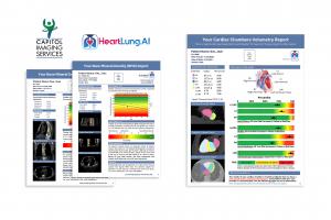 HeartLung AI's AutoBMD™ and AutoChamber™ reports with the HeartLung and Capitol Imaging Services logos