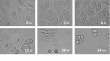 Breakthrough Cancer Drug Makes Cancer Cells Collapse from Within — No Harm to Healthy Tissue