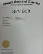 HPV BCR™ Method Gains AI Recognition for Wart Treatment