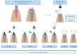 Microbial pioneers: how bacteria shape dental implant health from day one