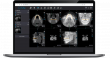 DSN Software Launches the First Cloud-Based Imaging Platform for Dental Specialists