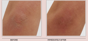 Kaplan_new_before_after_June_25