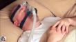 Sleep Apnea Diagnostic Systems Market to Reach USD 6.22 Billion by 2035