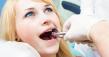 Vayner Emergency Dentistry Delivers Critical Emergency Tooth Extractions in Reseda