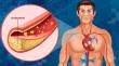 Cholesterol API Market Set for Steady Growth Through 2035