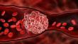 Hemophilia A Market Epidemiology Report 2025-2035: Drug Pipeline, Treatment, Trends, Rising Incidence & prevalence