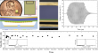 Charge once, power long: ultrasonic solution for implantable devices