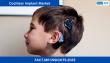 Cochlear Implant Market is Predicted to Reach USD 4,037 Million by 2035, Expanding at a CAGR of 6.1% | Fact.MR