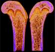 Aging Disrupts Osteocyte Networks and Bone Structure, with Greater Impact in Males