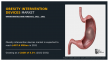 Global Obesity Intervention Devices Market on the Rise: Innovations and Awareness Drive Growth