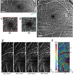 SELF-OCTA performance in field of view extension and high-dynamic-range flow velocity.