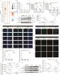 Unlocking the role of Lcn2 in COVID-19 lung damage