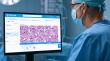 Study Validates Techcyte Fusion™ AI-Assisted Kidney Biopsy Evaluation to Improve Organ Allocation Efficiency
