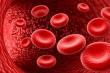 Thrombocytopenia Market Size to Reach USD 5.4 Billion by 2035 - Epidemiology Report by IMARC Group