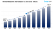 Dental Implants Market Report 2025 Edition: Industry Size, Share, Growth and Competitor Analysis