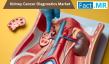 Kidney Cancer Diagnostics Market to Reach USD 2,015.3 Mn by 2035, Fuelled by Rising Cancer Prevalence