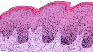 3D Epidermis