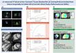 AI-Powered CT Chamber Volumetry Predicts Heart Failure Risk As Accurately As MRI, New Study Shows