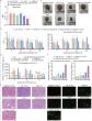 High-efficacy adjuvanted subunit vaccine against variant infectious bursal disease virus in chicks
