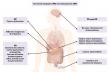 eGastroenterology Review Redefines Functional Dyspepsia, Gastroparesis Treatment