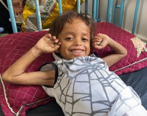 23468480 severely malnourished child in