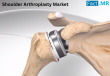 Shoulder Arthroplasty Market to Hit $2.7B by 2035, Driven by Innovation from Key Players like Zimmer Biomet & Stryker