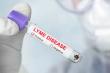 Lyme Disease Diagnostics Market Driven by Rising Tick-Borne Infections and Early Detection Demand | DataM Intelligence