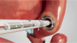 Revolutionary Magnetic Anastomosis System Wins FDA Clearance
