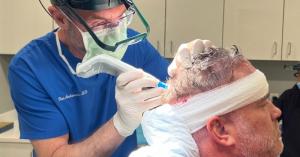 FUE and FUT hair transplants