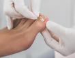 Foot & Ankle Specialists of Arizona Address Common Nail Disorders With Targeted Care