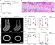 Genetically Engineered Mouse Model Provides Insights on Genetic Bone Disorders