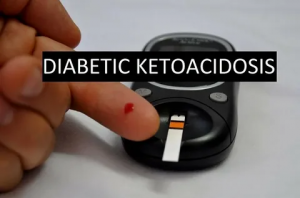 The Global Diabetic Ketoacidosis Market reached US$ 1 Diabetic Ketoacidosis market