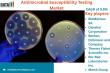 Global Antimicrobial Susceptibility Testing Market Set to Surge: Innovations Driving Rapid Growth 2025