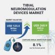 Tibial Neuromodulation Devices Market to Double Growth by 2035, Driving Next-Generation Opportunities for Manufacturers