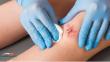 The US$ 45.5 B Lifeline: Wound Healing Market's Decade of Innovation Driven by Chronic Disease and Tech | TMR Research