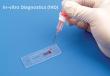 In-Vitro Diagnostics Market Set to Reach $131.68 B by 2032 Driven by Chronic Disease Burden and Breakthrough Innovations