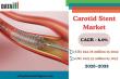 Carotid Stents Market Trends | Self-Expanding Stents, Aging Population and Stroke Risk Drive Growth | DataM Intelligence