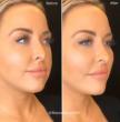 'The Era of the Subtle Edit' – Epione Beverly Hills and Dr. Simon Ourian Redefine Beauty with Minimal, Refined Tweaks