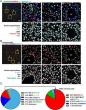 Mapping Liver Macrophages May Unlock New Therapies for Organ Repair
